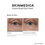 Before and after comparison of a person's eye area showing wrinkle improvement over 8 weeks, with the text 'SKINMEDICA Instant Bright Eye Cream' at the top on a white background.