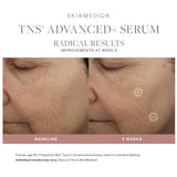 Before and after comparison of SkinMedica TNS Advanced+ Serum on a woman's face, showing improvements at Week 2.