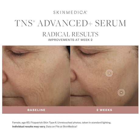 Before and after comparison of SkinMedica TNS Advanced+ Serum on a woman's face, showing improvements at Week 2.